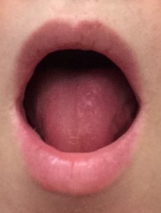 mouth2