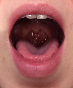 mouth1